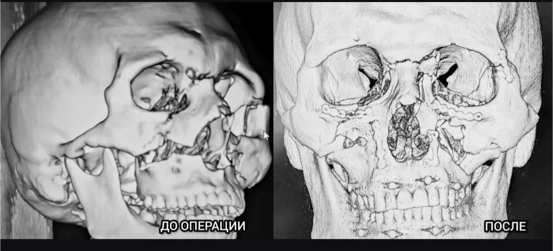 Операция длилась три часа