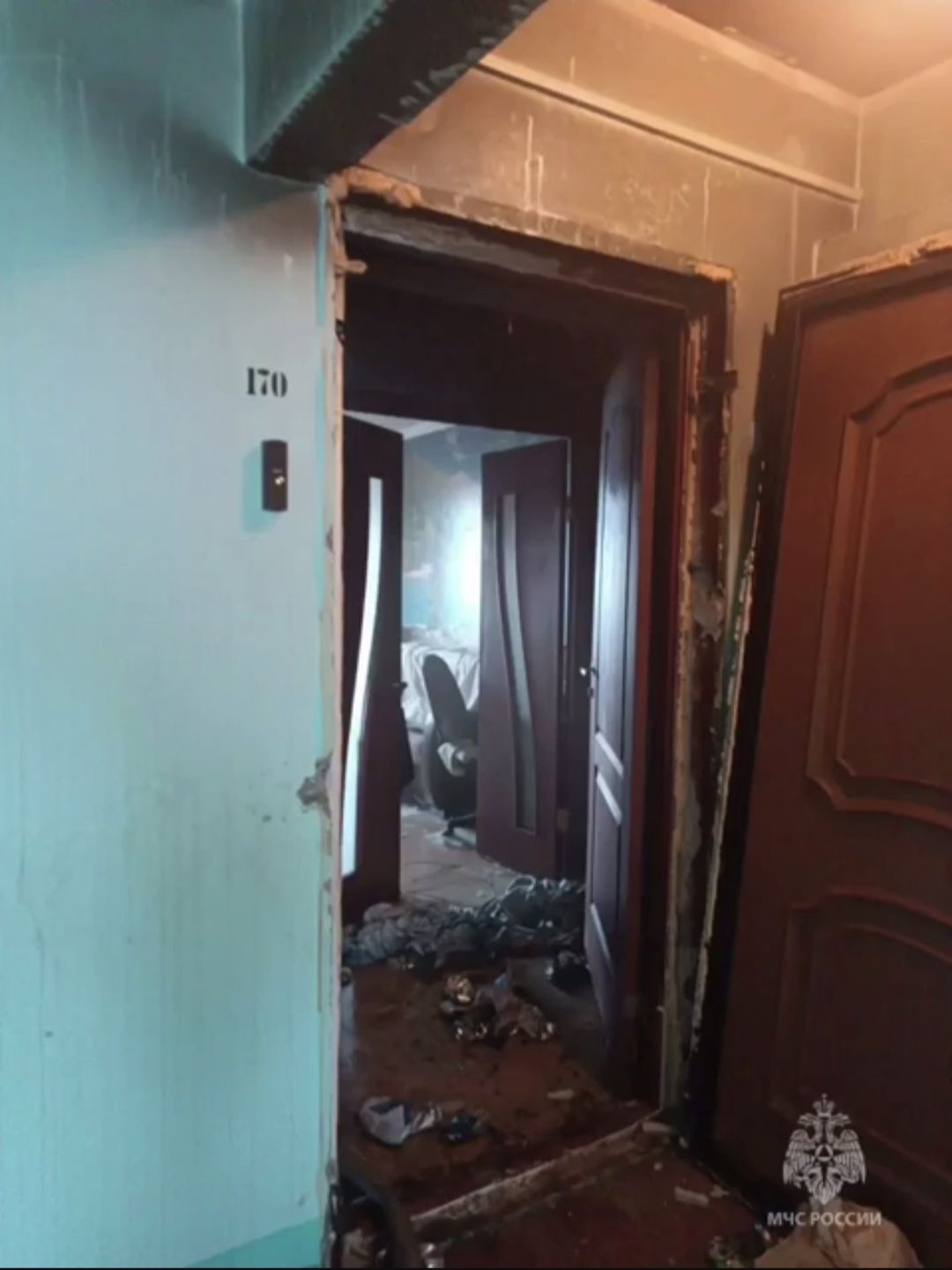 В Челнах женщина получила глубокие ожоги из-за неосторожного курения