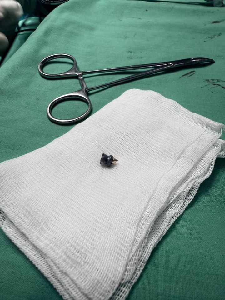 Случайный выстрел: в Татарстане мужчине удалили пулю, застрявшую в позвоночнике Случайный выстрел: в Татарстане мужчине удалили пулю, застрявшую в позвоночнике