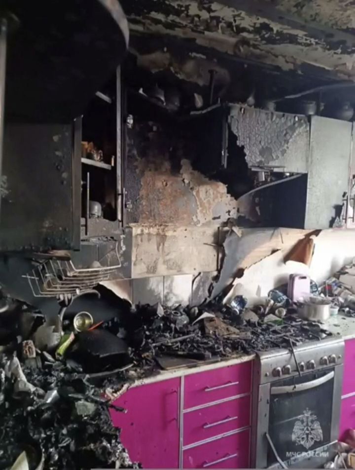В Челнах женщина получила глубокие ожоги из-за неосторожного курения